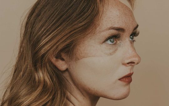 Care sunt remediile naturale pentru dermatita