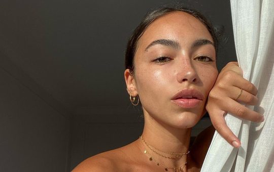 Cum poti sa vindeci urmele lasate de acnee